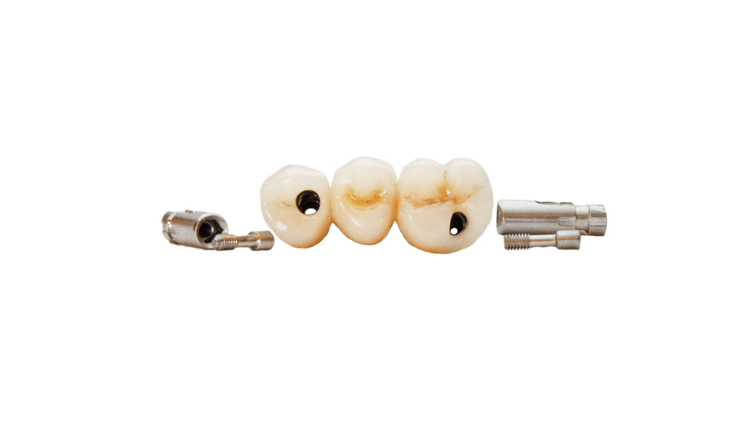 Átmenőcsavaros-implant-híd-Takács-Labor
